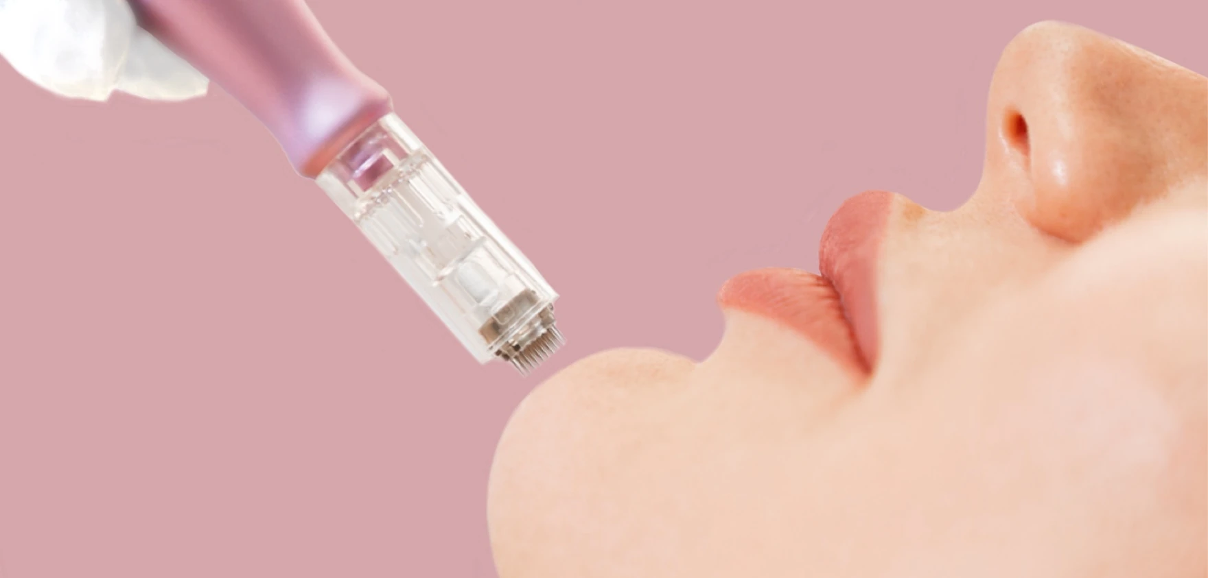 Kalman Aesthetiks Microneedeling